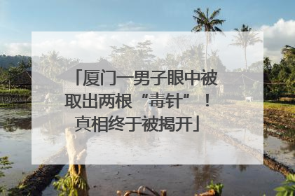 厦门一男子眼中被取出两根“毒针”！真相终于被揭开
